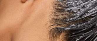 Understanding Causes of Oily Scalp and Their Impact