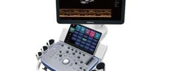 Настройки и функции: как управлять современными УЗИ-аппаратами